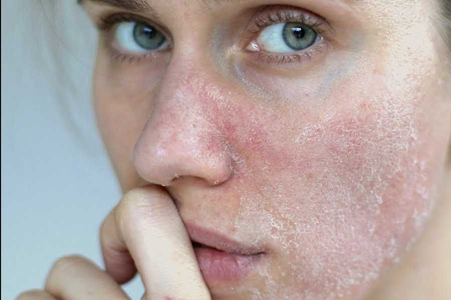This is a list of vitamins and supplements for dry skin